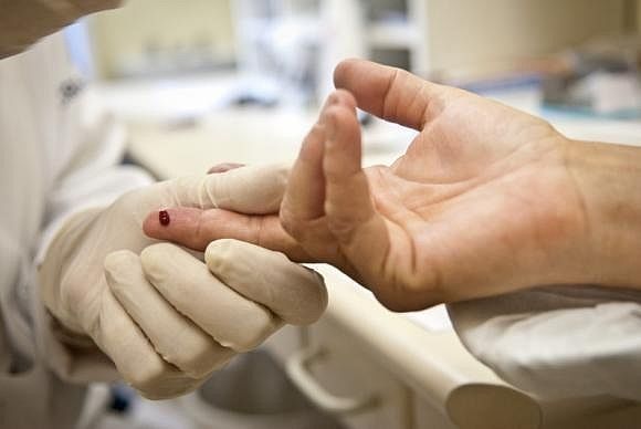 Teste rápido detecta, entre outras doenças, a presença do vírus HIV