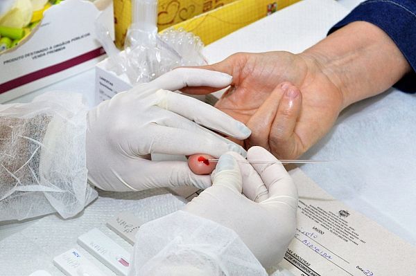 Teste rápido de HIV está disponível em postos de saúde dos 102 municípios alagoanos